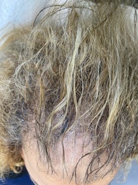 a woman's hair with a lot of hair on it