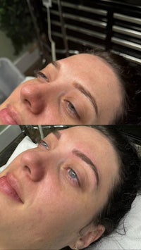 before and after pictures of a woman's eyebrows
