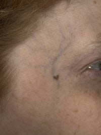 a close up of a woman's eye with a scar