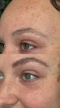 a woman's eyebrows before and after treatment