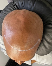 a man with a bald patch on his head