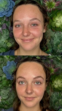 before and after photos of a woman with freckles