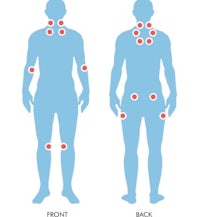 a diagram showing the different types of pain in the body