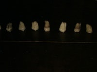a row of teeth in a dark room