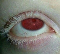 a close up of a person's eye with a red eye