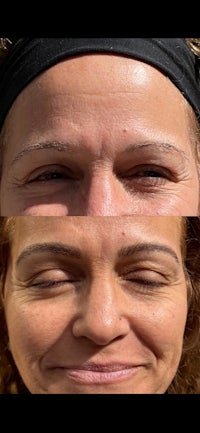 before and after photo of a woman's eyebrows