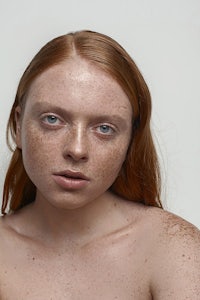a woman with red freckles is posing for a photo