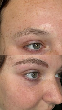 a woman's eyebrows before and after treatment