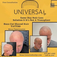 a flyer for the buzz cut hair transplant