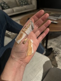 a person's hand with a bandage on it